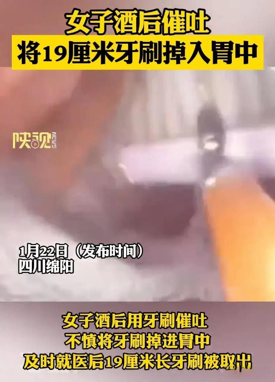 该说不说，酒后催吐不都是用手指抠嗓子眼吗？我是第一次听说还有用牙刷催吐的！这牙刷
