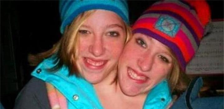 美国双头连体姐妹共生34年, 其中一位结婚了! 网友: 另一位咋办?