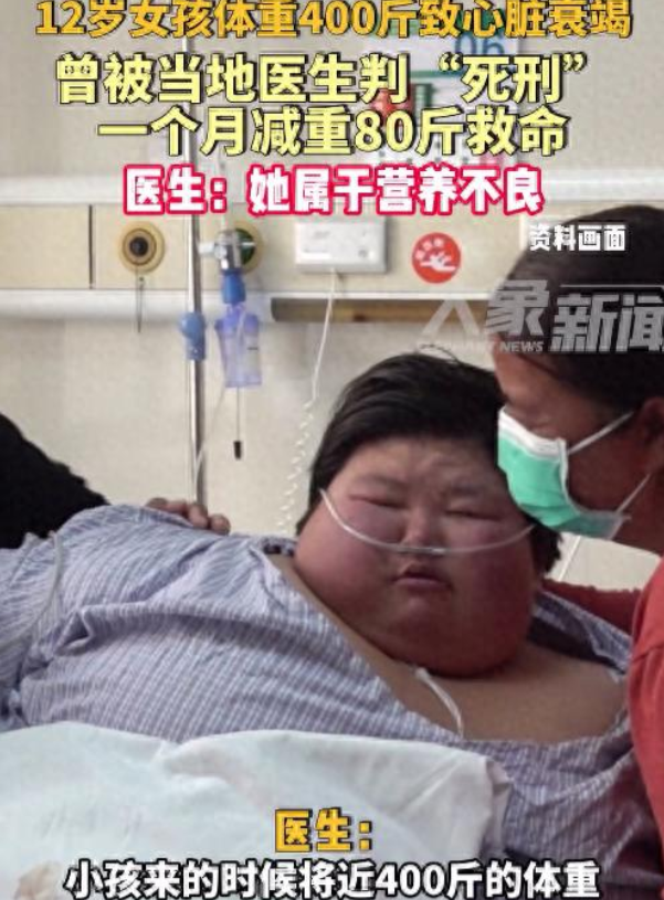 12岁400斤女孩一个月减重80斤！医生：她属于营养不良？河南开封兰考一位12岁