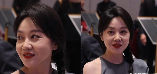 闫妮应该不屑于在脸上动手脚吧？可她额头上的那道坑是怎么回事？