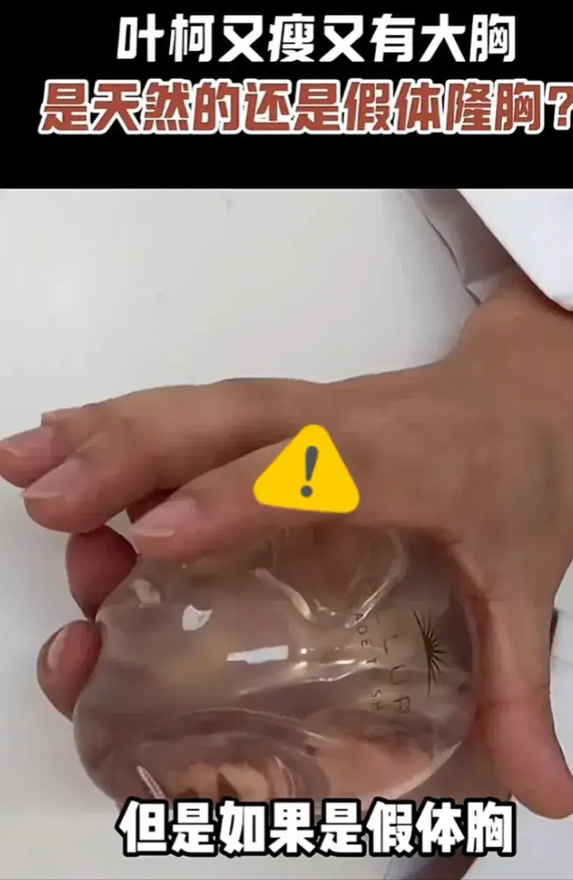 叶珂的假胸隆得比肚子还大,都垂到腰了,黄晓明要注意什么?(叶珂 整容)-第10张图片-九妖电影 叶珂的假胸隆得比肚子还大,都垂到腰了,黄晓明要注意什么?(叶珂 整容)-第10张图片-九妖电影