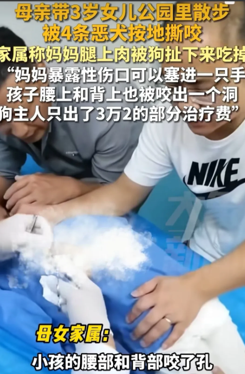 江西赣州，妈妈带着3岁的女儿去公园散步，不料4条恶犬迎面扑来撕咬她们，妈妈腿上的