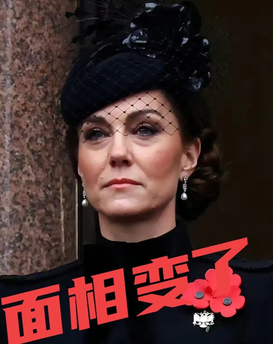 凯特王妃，面相变了！

凯特王妃面相变了，面容已经苍老了，

凯特王妃面相变了，