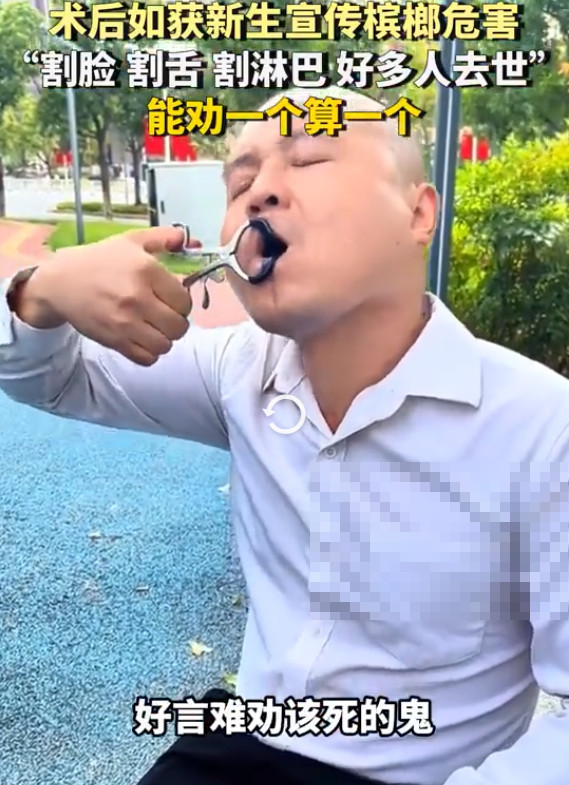 男子嚼槟榔15年割掉大半舌头：其他人别学我，我想劝你们忌口