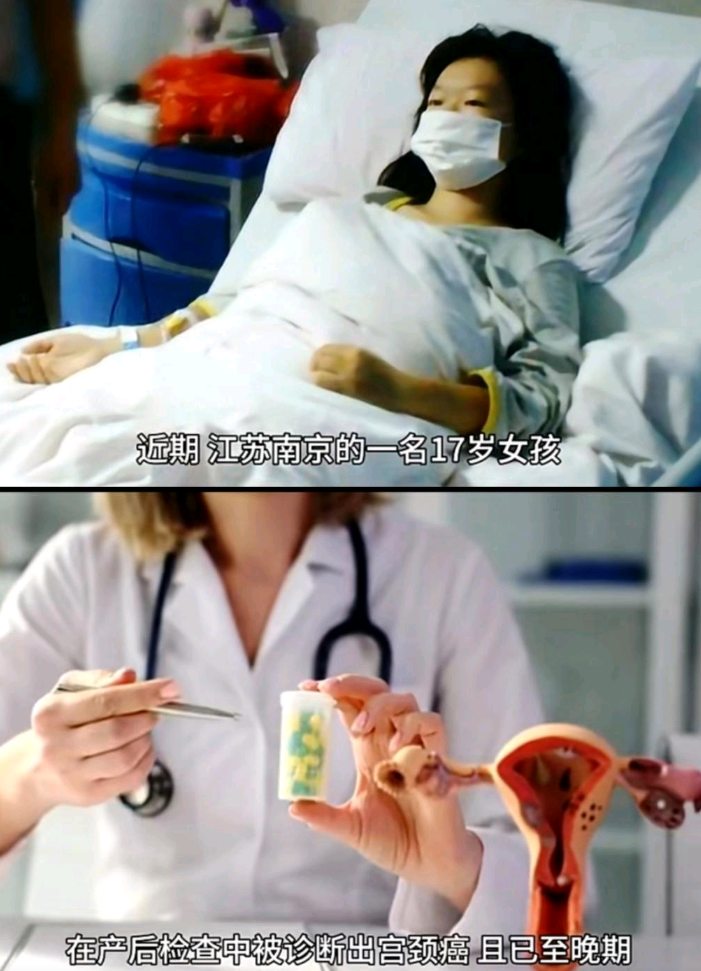 果然讨论的重点已经转到hpv疫苗上去了。

但是这不是重点。重点是这个女孩17岁