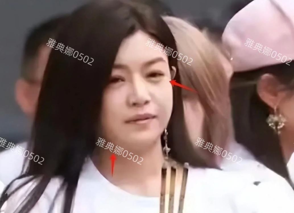 陈妍希被爆跟陈晓离婚后，顶着一张肿脸参加开机仪式，状态十分憔悴。
这部戏中41岁