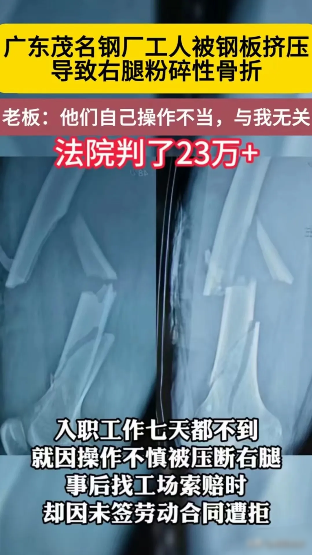 他自己倒霉，与我无关！广东，茂名。男子去朋友亲戚家的钢厂上班，刚去不到七天就因操