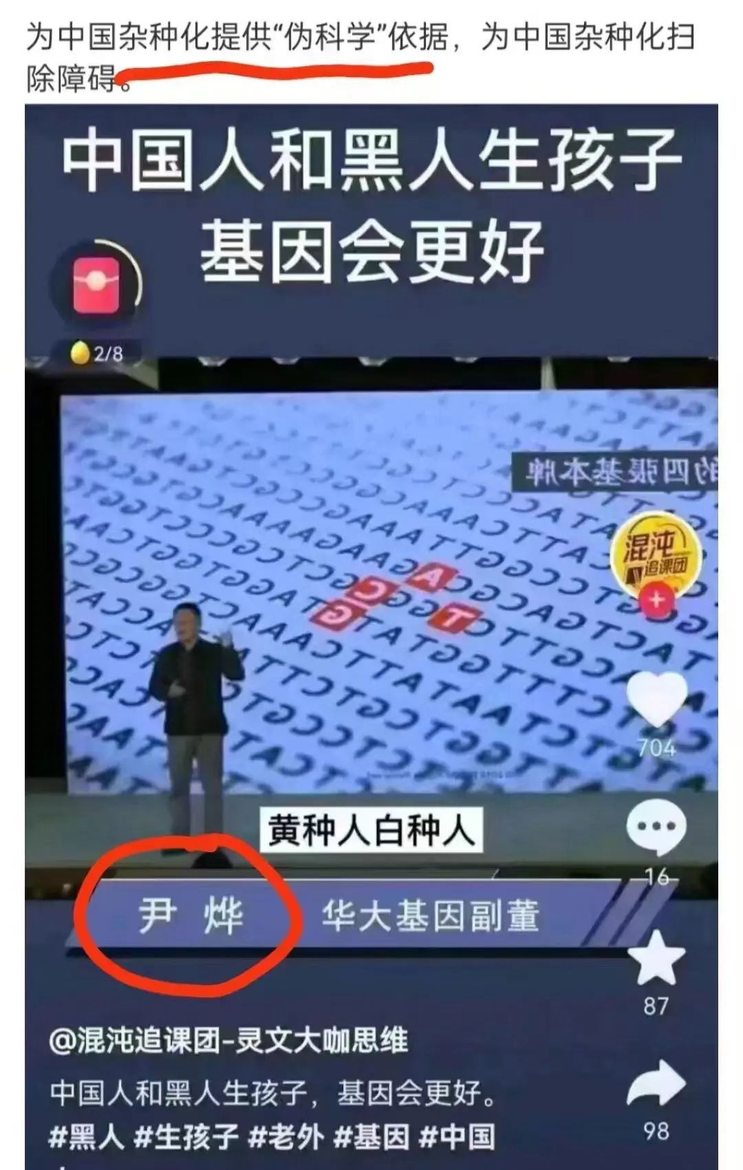 好专家
他一定会生个黑儿子