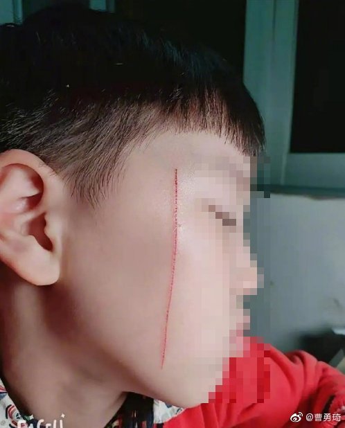 老师喊家长喊了很多次了