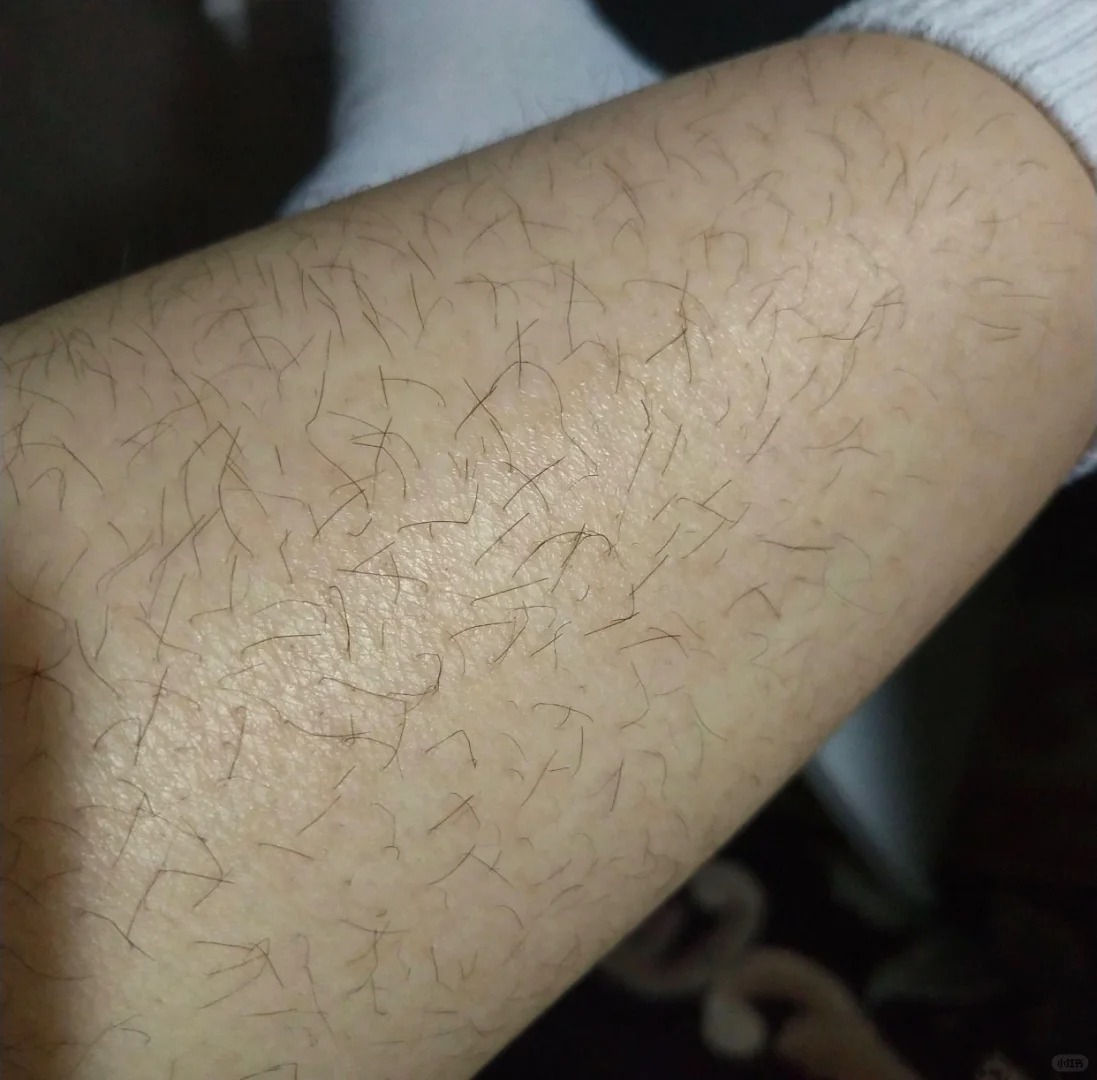 姐妹们，你们都是怎么脱毛的啊（尤其是腋下）
又快到穿短袖，吊带的季节了，但是毛毛