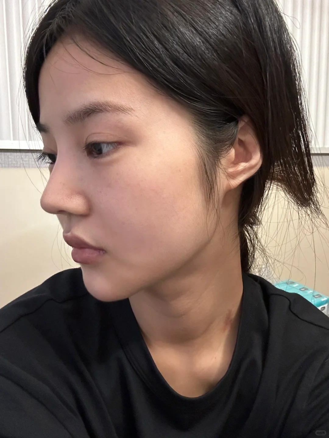 没打下巴vs打了下巴
区别还是挺大的