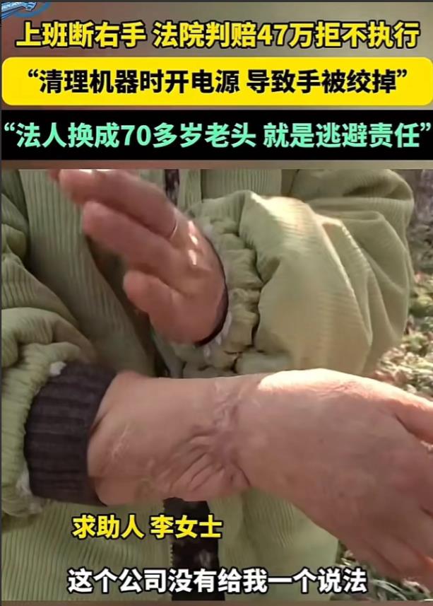 “钻了法律的漏洞！”河南漯河，女子上班右手被机器绞断，法院判工厂赔偿 47 万，