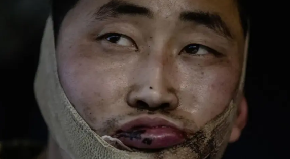 在库尔斯克的朝鲜军队已经损失了40%

据西方情报官员透露，正在俄罗斯库尔斯克作