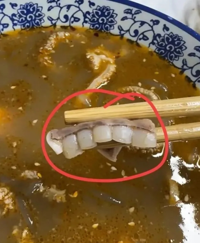 喝羊汤喝出到个牙，是不是应该免单