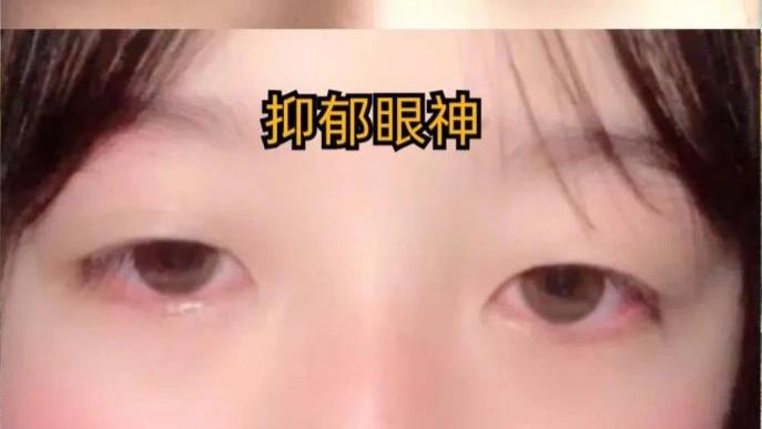 抑郁症的‘外貌信号’：这4大变化你注意到了吗？