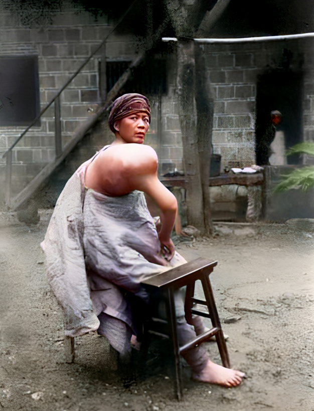 1932年，四川宜宾。一名男子坐在院子里，裸露的肩膀膨胀得像气球。突然，他扭头看