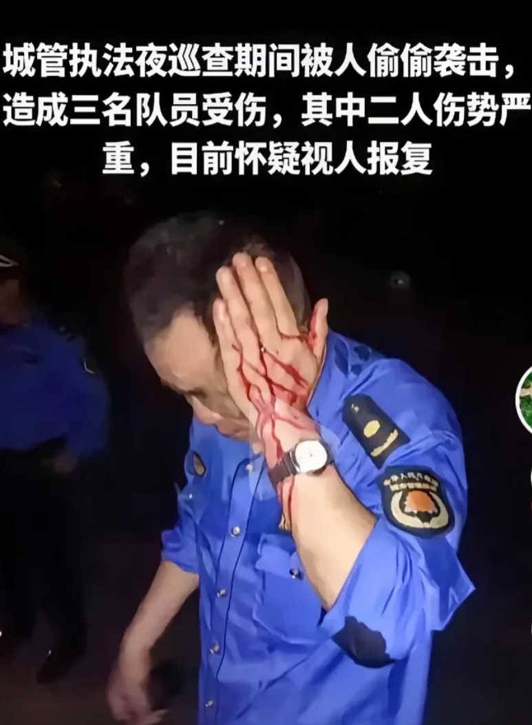 城管夜巡遭袭击？三名城管员也是倒霉，也许是别人惹的事却被无差别报复了，希望公安机