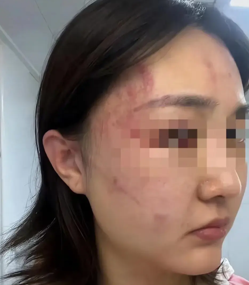 贵州遵义，一男子经常家暴妻子，得知妻子娘家分了土地补偿款，命令妻子回去拿，妻子认