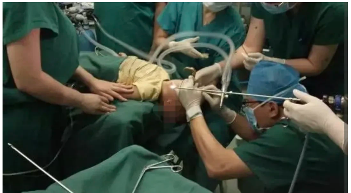 河南商丘，一对父母在游乐园买了根棒棒糖，4岁的儿子吃糖时，糖进入气管，孩子窒息身