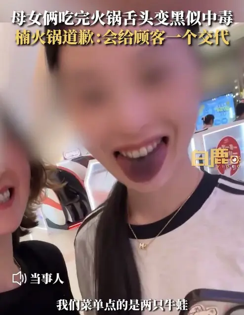 6月13日，在浙江杭州。一女生发视频称和母亲在楠火锅就餐后舌头变黑。当事人称点的