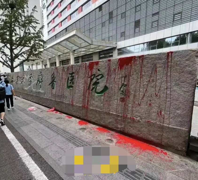 山东齐鲁医院，他们真的敢下手。
家里79岁的老人，脑血管有堵塞。青岛医学院附属医