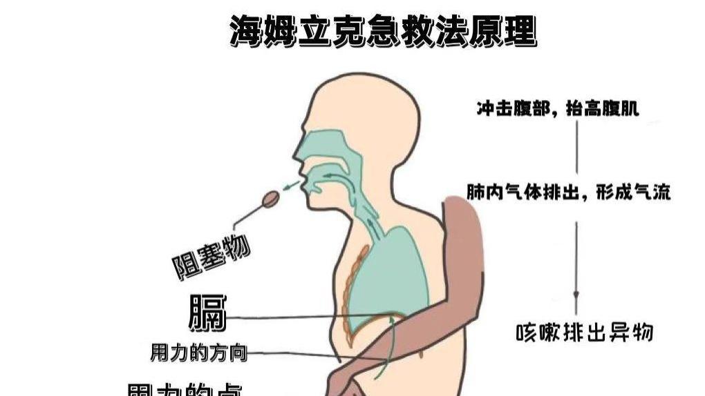 1.半年咳嗽不止，9岁男孩的肺里竟藏了一支笔！