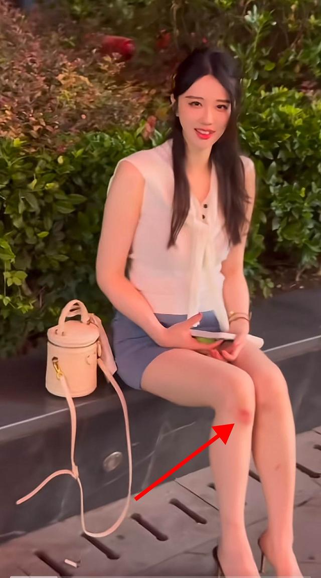 轩子巨2兔晒美照出现意外,膝盖出现明显伤痕,网友:羡慕力哥!-第4张图片-九妖电影 轩子巨2兔晒美照出现意外,膝盖出现明显伤痕,网友:羡慕力哥!-第4张图片-九妖电影