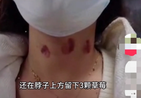 上海，女子吃药醒来后，发现脖子上有被吮吸出来的3个唇印，浑身像散架子一般酸痛无力