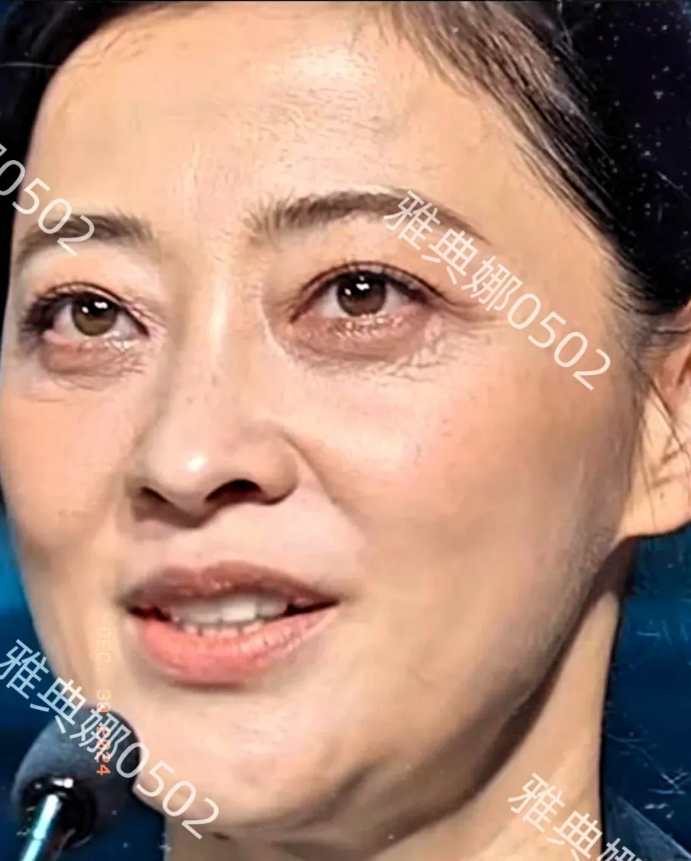 梅婷才49岁怎么这么老？
她头发稀疏有白发，眼睛不但黑眼圈严重，眼周满是皱纹，不