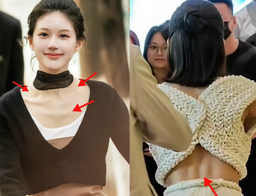 赵露思就是被白幼瘦审美害了，病到坐轮椅也在意料之中