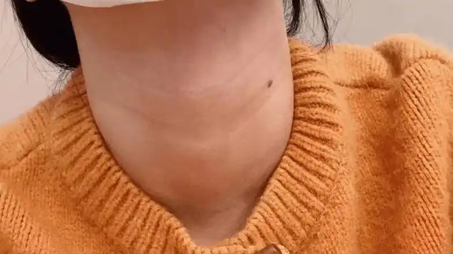 般来说，脖子越粗，心血管系统出问题的风险就越大，同时也更容易衰老。