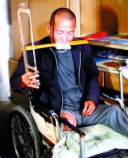 2012年4月，河北一位男子为了节省百万住院费用，自己动手锯掉了右腿，整个过程耗