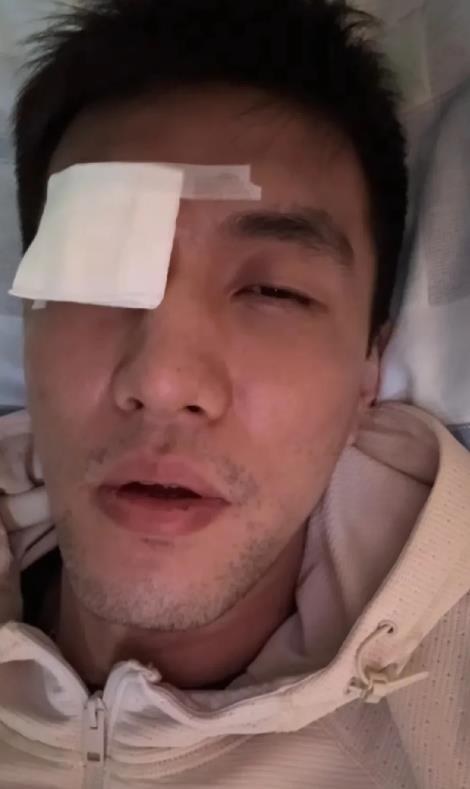 祝福艾伦！郭艾伦在队内训练赛中，被队友戳到了眼睛，需要进行缝针治疗！

现在艾伦