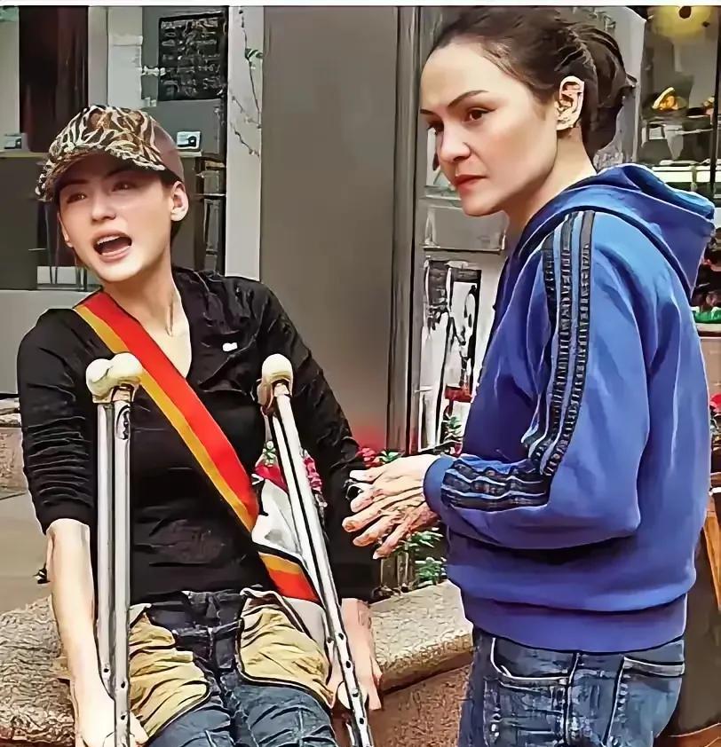 有一回，张柏芝不小心摔伤了腿。她妈妈知道后，嘴上一边数落着她怎么这么不小心，语气