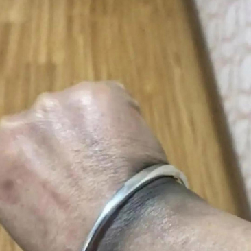    老婆送了老妈一只银手镯，本是一番好意。然而，老妈戴了仅仅一天，她的手却变成