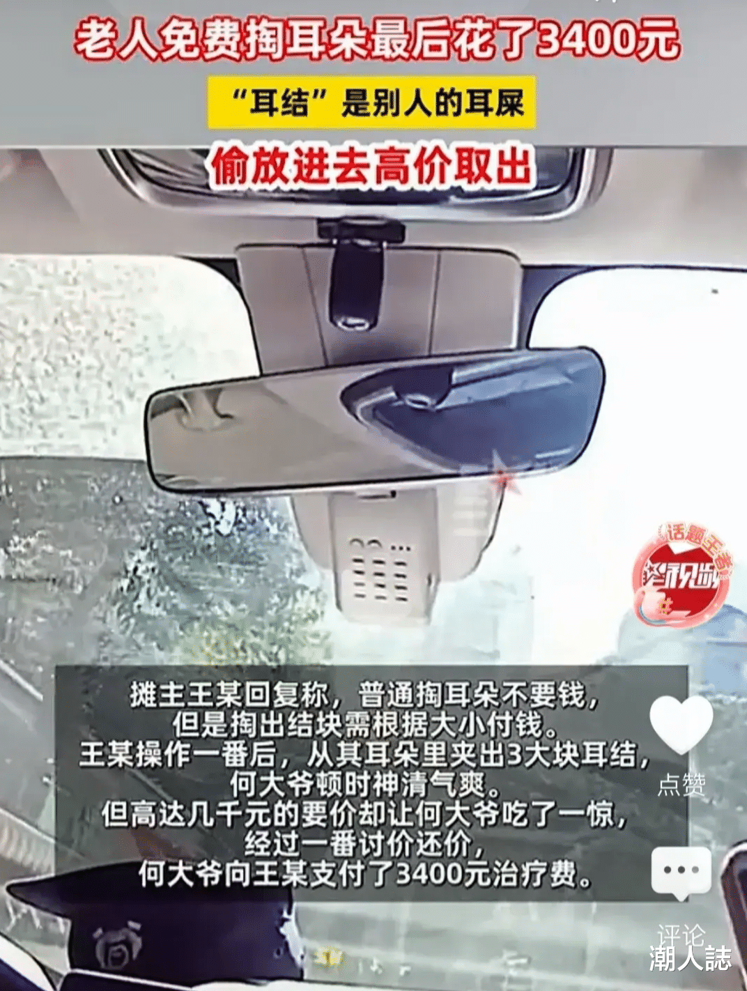 老人免费掏耳朵, 花了3400元高价取出“耳结”, 竟是别人的耳屎