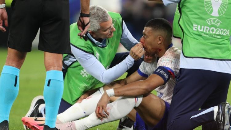 姆巴佩不会接受鼻子手术