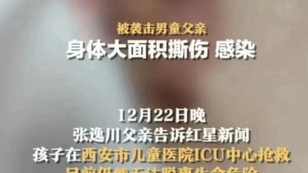 众怒：4 岁男童被恶犬咬伤，还在ICU抢救，爱狗人士发不当言论