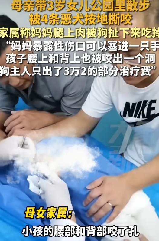 江西赣州，妈妈带着3岁的女儿去公园散步，不料4条恶犬迎面扑来撕咬她们，妈妈腿上的