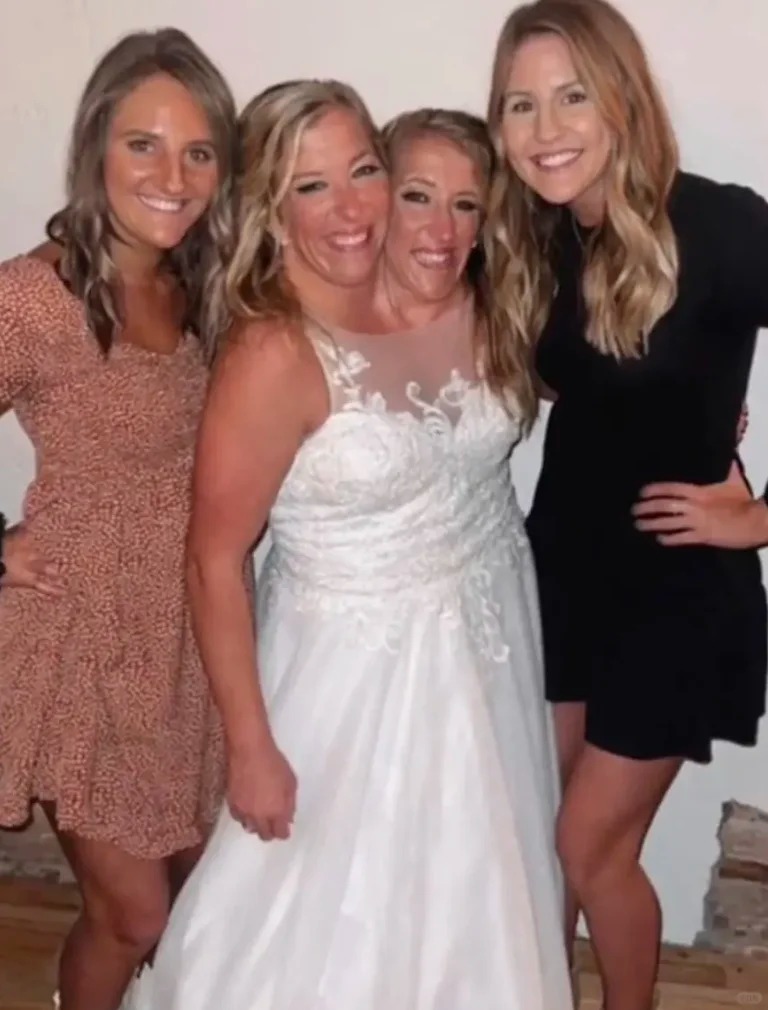 美著名双头连体双胞胎姐妹结婚，丈夫是军人
美国一对著名的连体双胞胎姐妹艾比和布列