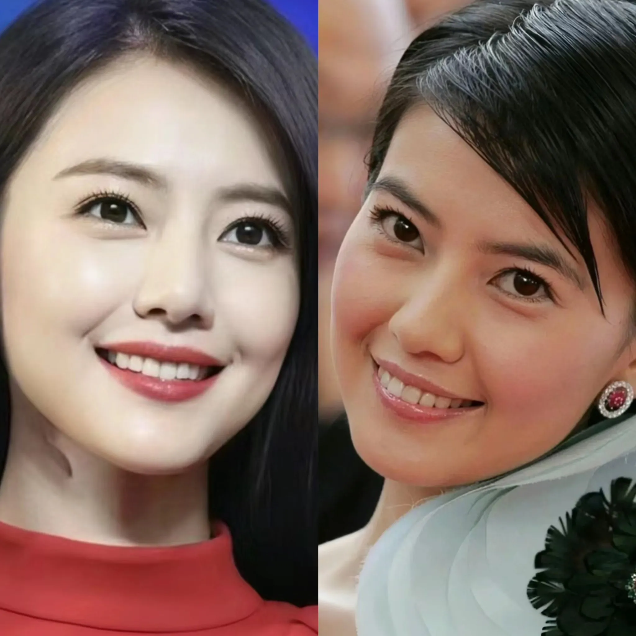 清纯美女高圆圆只是换了美容烤瓷牙，整个人笑起来的气质都完全不一样了，还有一方面就