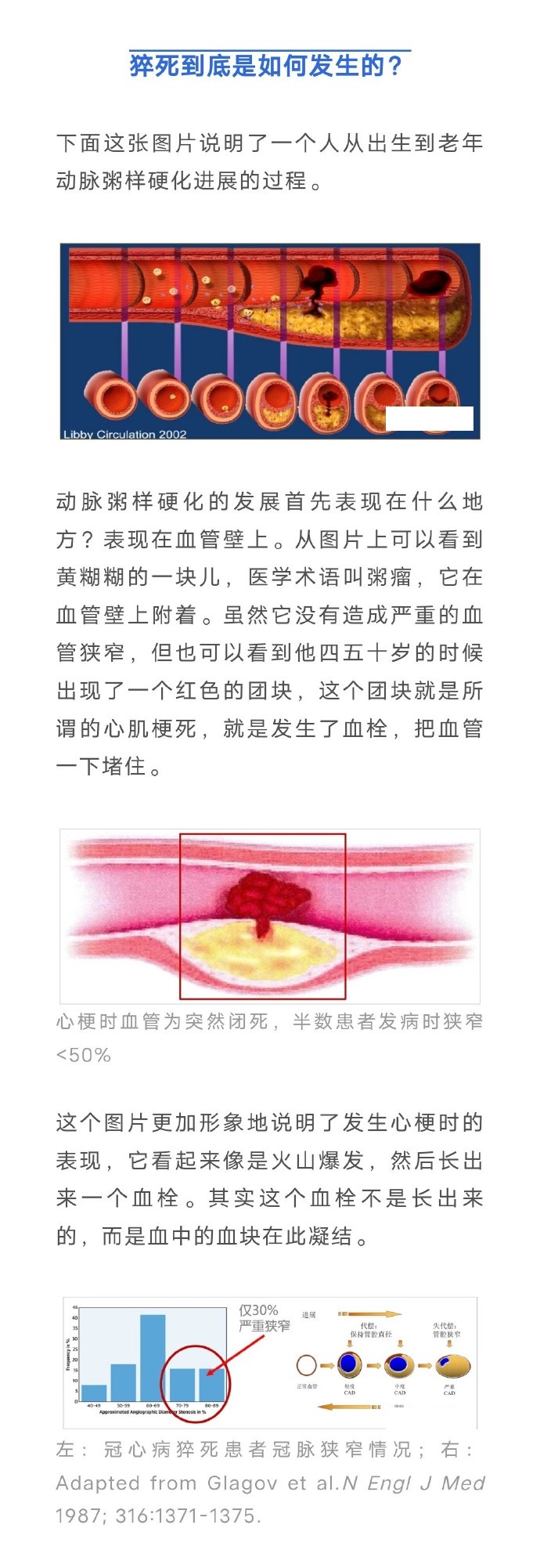 这种运动员，如果有心脏病史或某种基础病，就不可能进入国家队。

所以，此前必然是