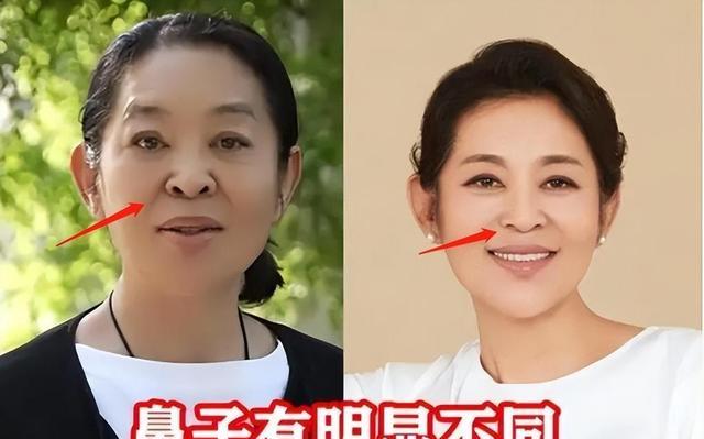 宁愿丑成“怪物”也要永葆青春，这7位明星早已整的“惨不忍睹”（十大明星整容失败）-第27张图片-九妖电影
