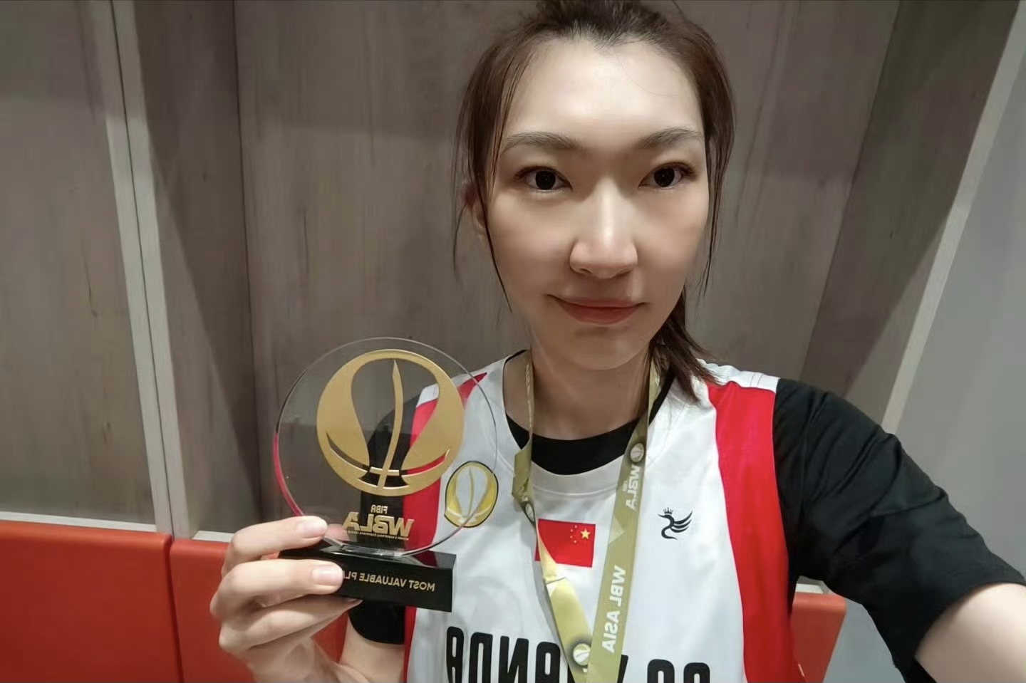 韩旭割双眼皮之后确实变美了