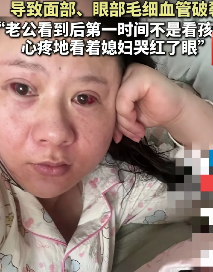 近日，山东的一位年轻妈妈因为没有经验，在产房生孩子时不会用力，结果力气都用在了脸