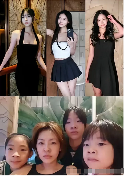小S这3个女儿，都是女大十八变的真实写照。
小时候都是单眼皮，肿眼泡，大了全是双