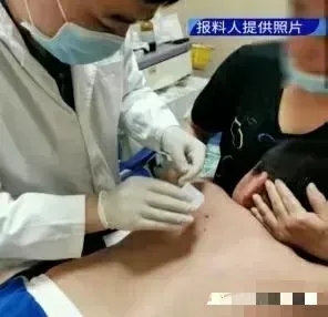 广东，女子给7岁儿子洗澡时，孩子老是说后背疼，女子检查后发现，孩子的身上有密密麻