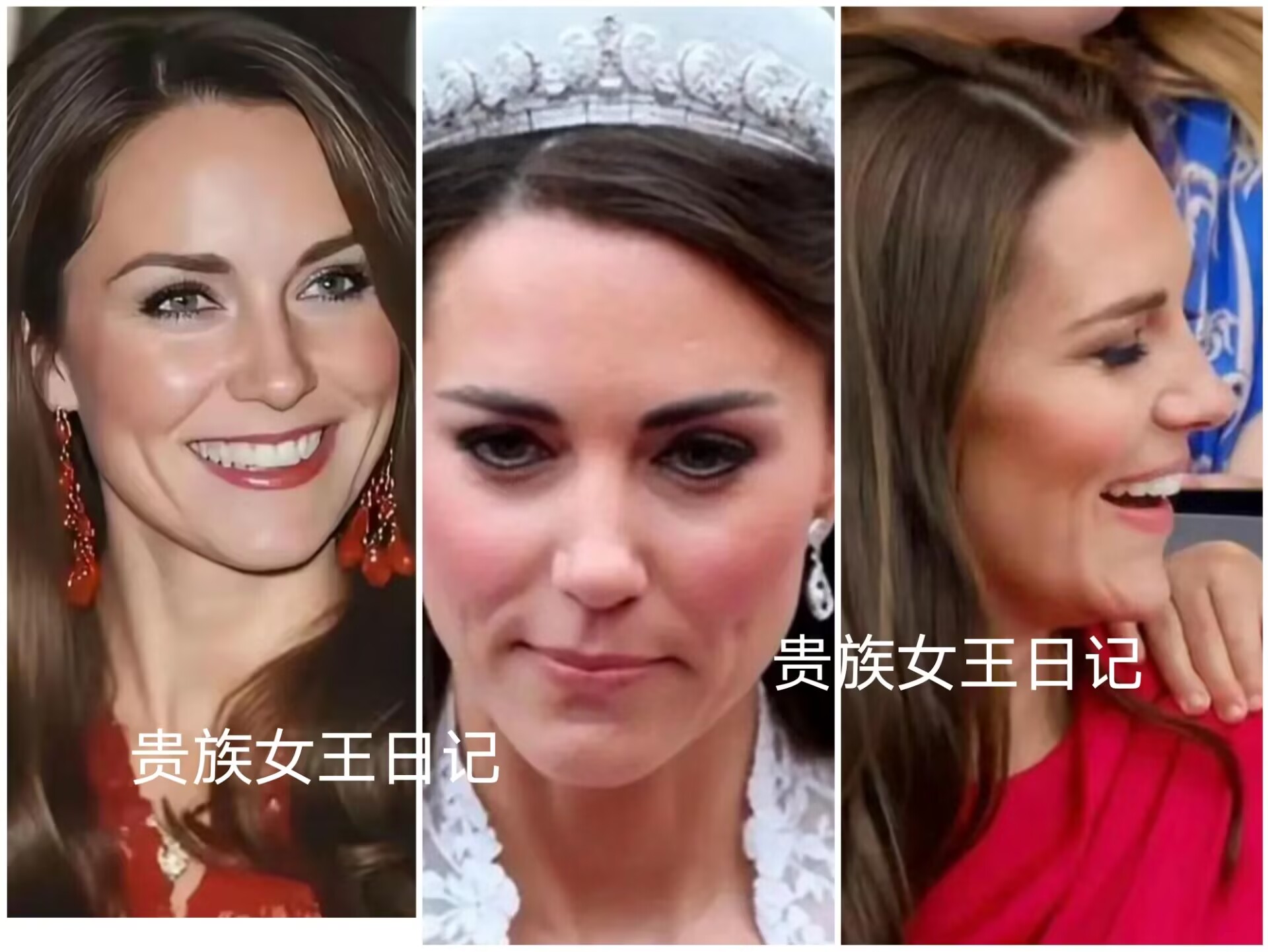 凯特王妃脸部的秘密，名人圈心照不宣，美丽动人的背后用金子堆砌（凯特王妃的面相）-第6张图片-九妖电影