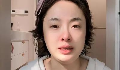 孙铱自曝健康危机，网友揪心！
最近，演员孙铱在社交平台毫无保留地分享自己的健康困