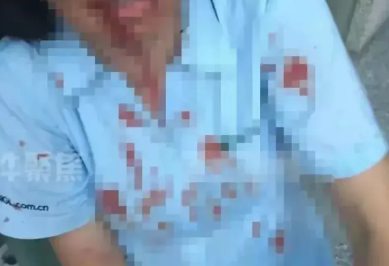 上海，男子带5人上门对舅舅进行围殴，舅妈激愤之下，拿起一瓶强腐蚀性液体，直接泼向